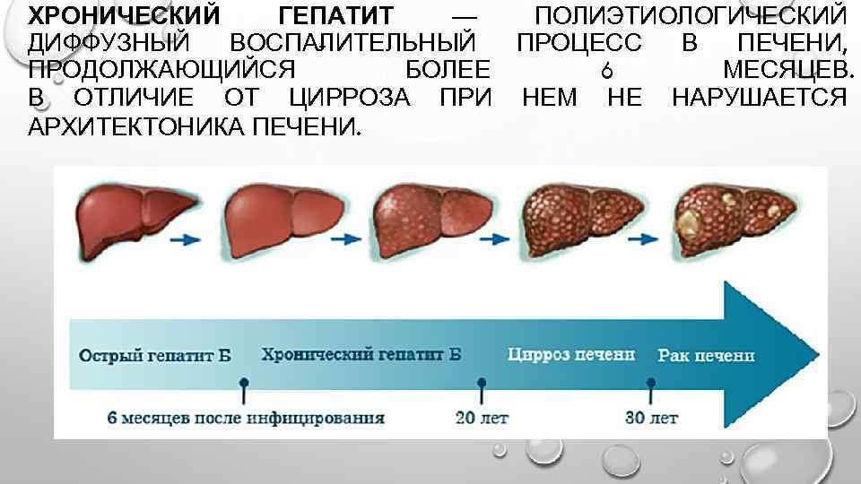 печень печень