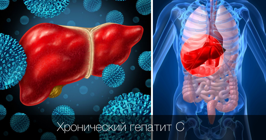 клинические рекомендации по диагностике Гепатита С