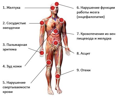 как выявить гепатит С